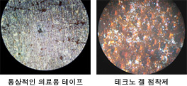 피부에 붙인 후의 비교