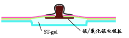 ST-gel用于心电图电极的使用例